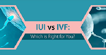 IUI vs IVF - IVF Specialist Kolkata